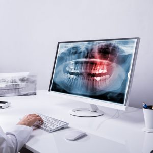 Dentist Looking At Teeth X Ray On Computer